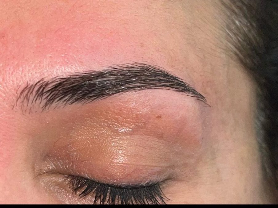 Uygulama sonrası — Begüm Soyalp Atelier Bursa